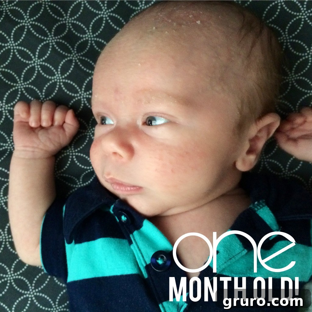 Ryder's Twelve-Month Odyssey 3 Ryder at one month old, experiencing cradle cap and baby acne